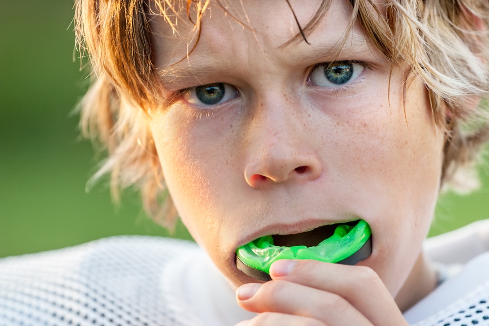 Ask Your Cuero Dentist: Sports Mouth Guards