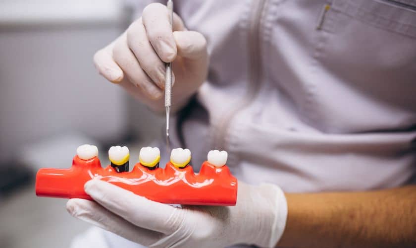 When Are Dental Crowns Necessary? Signs You May Need One