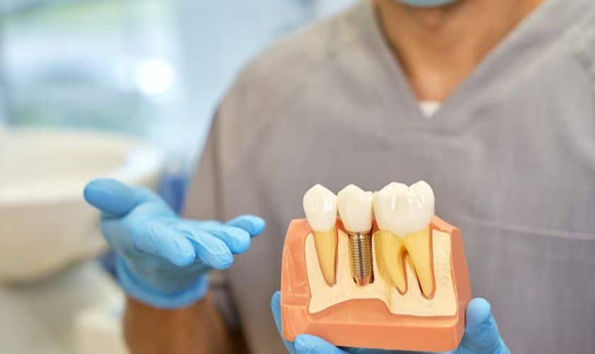 How Are Dental Implants Beneficial To Your Overall Oral Health?