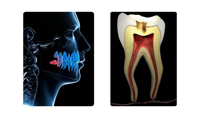 Unveiling the Anatomy of Your Tooth: Understanding the Role of the Crown